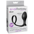 ANAL FANTASY - SAMMLUNG ASS-GASM ERWEITERTER ANUSRING MIT ANUSPLUG
